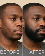 Load image into Gallery viewer, HUILE DE POUSSE DE BARBE